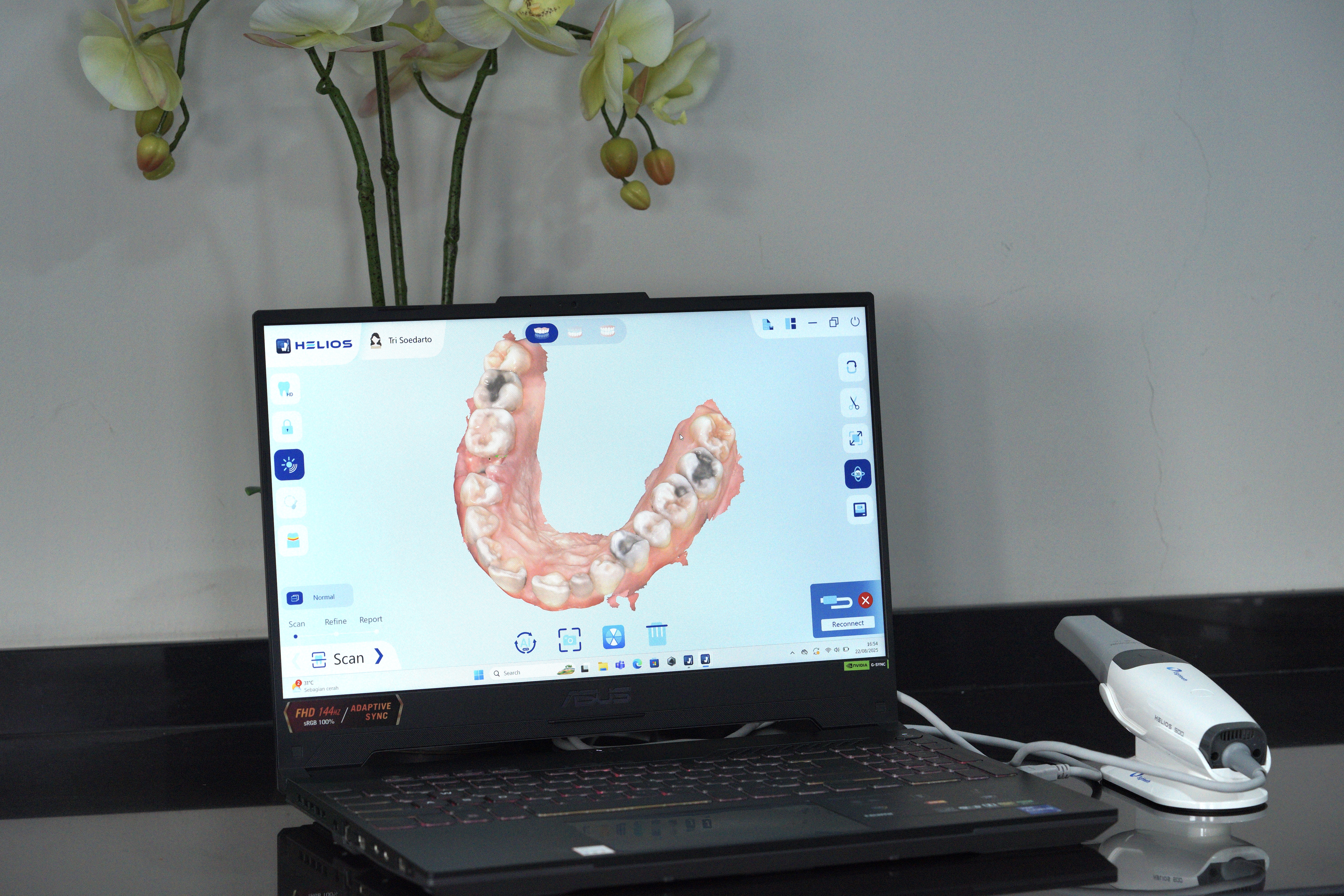 3D dental scanner di Alenza Dental Care