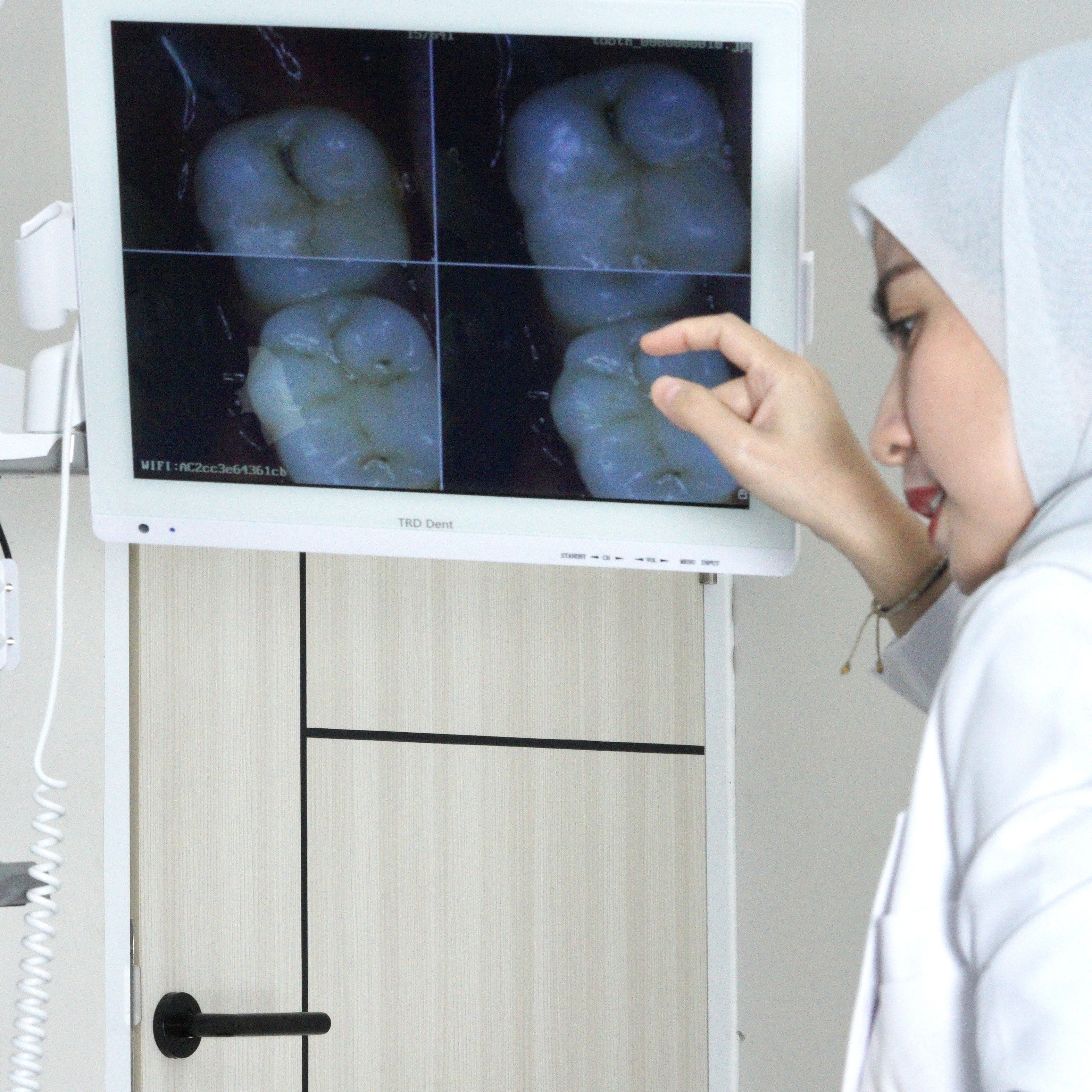Intraoral camera di Alenza Dental Care