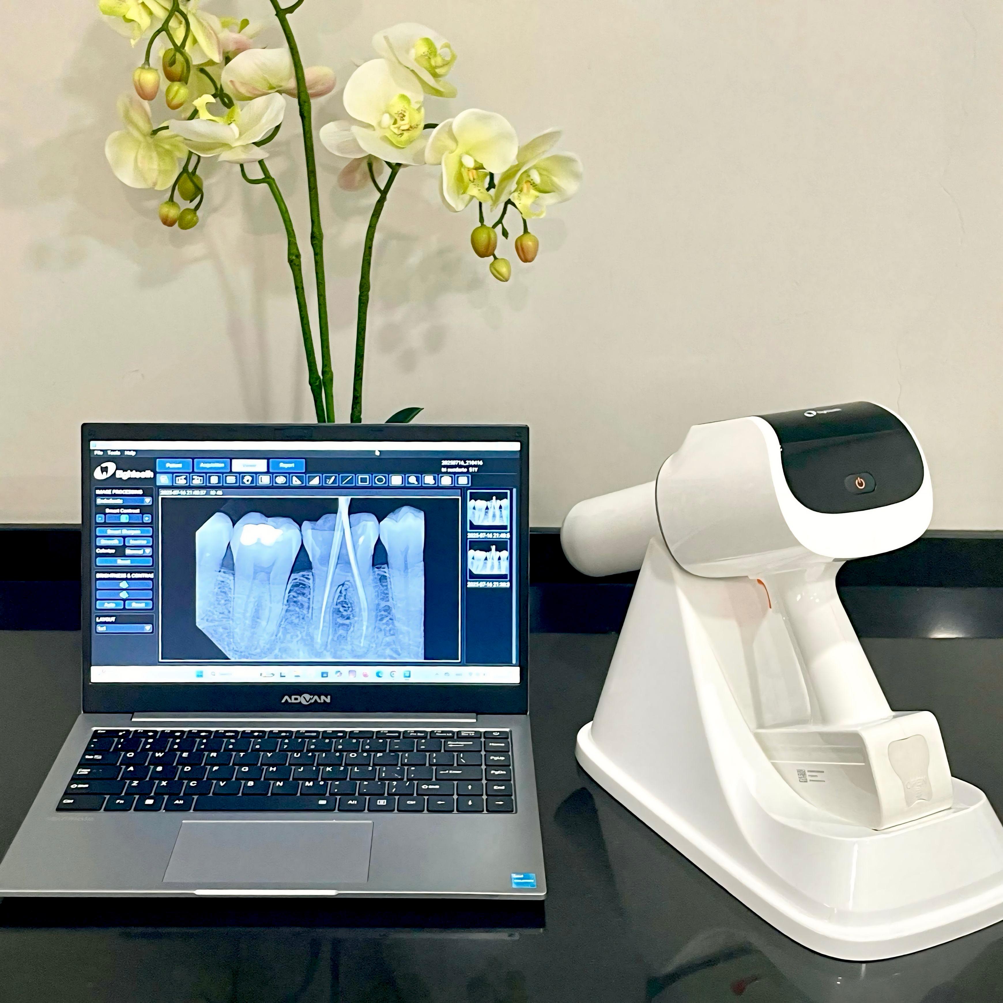 Portable X-Ray di Alenza Dental Care