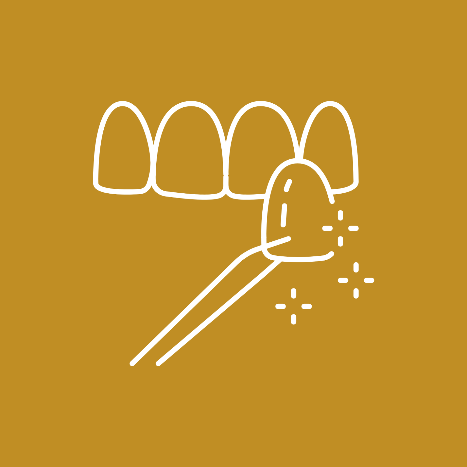 Placeholder Veneer Gigi